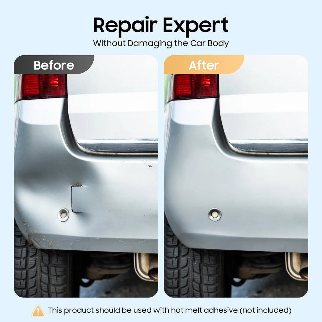 Dent Removal Kit – Professional Paintless Dent Repair Tool